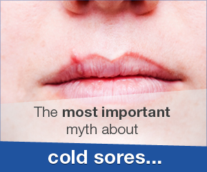 Cold Sore - Fact vs Myth
