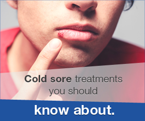 Cold Sore - Treatment